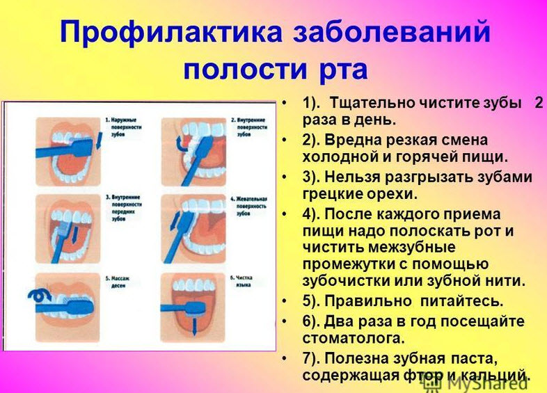 Презентация профилактика заболеваний полости рта